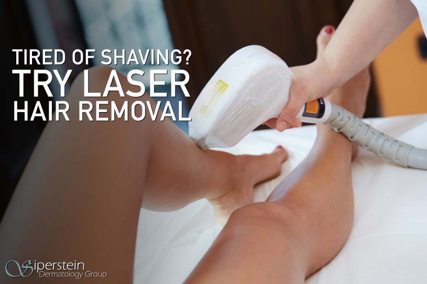 laser hair removal