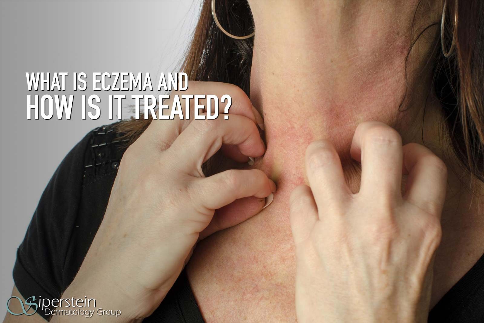 Eczema A Common Cause Of Itchy Skin