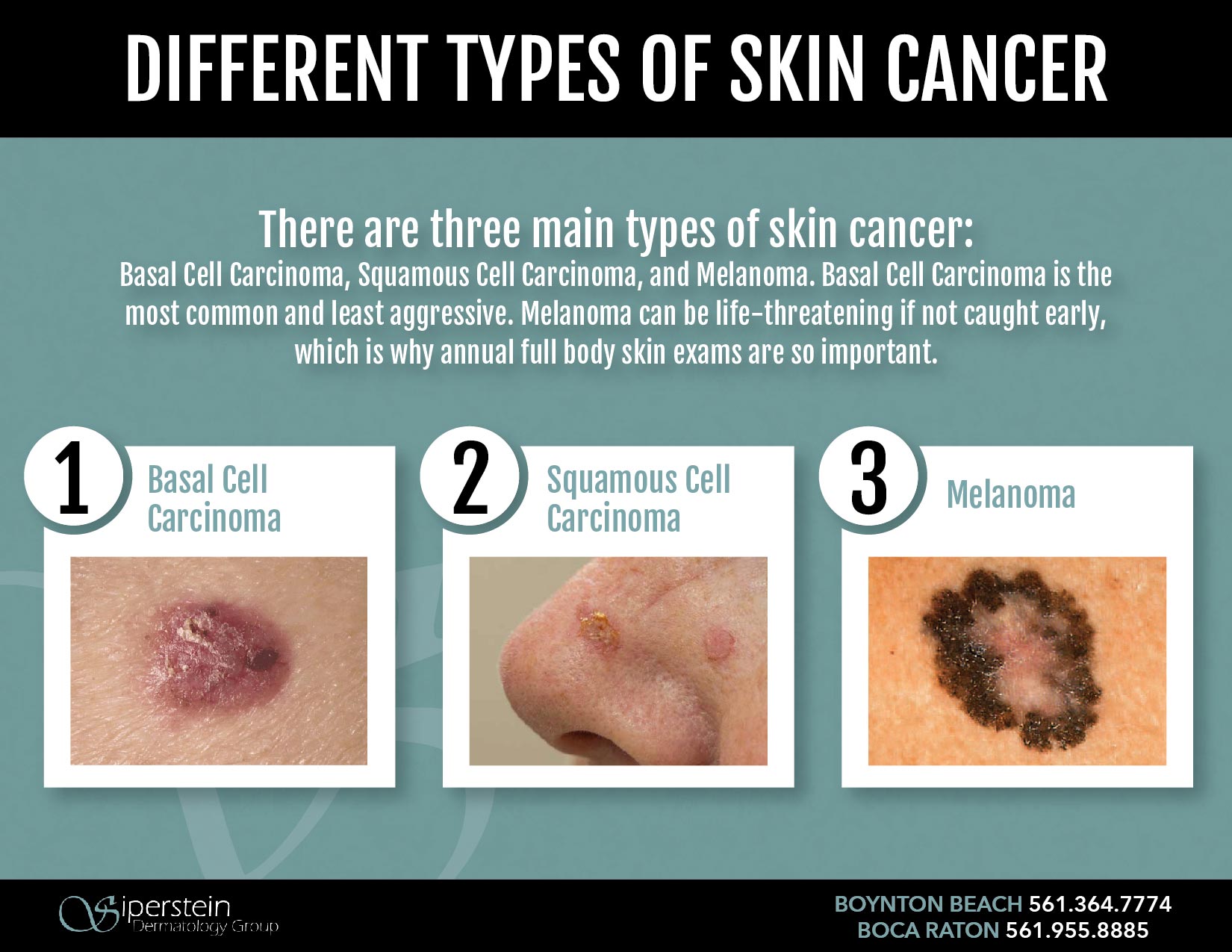 most common type of skin cancer lanceembry