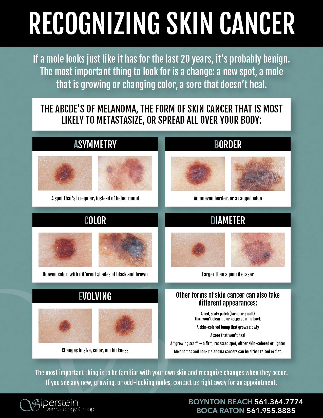 research on skin cancer