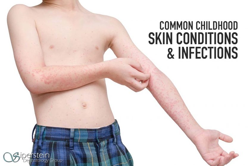 Skin Conditions