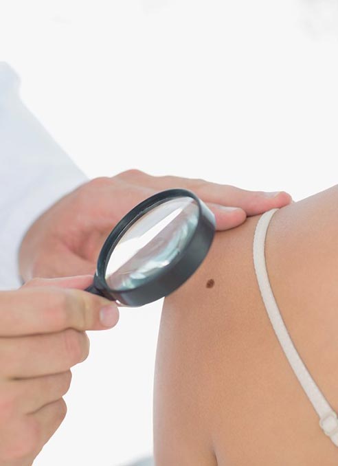 skin cancer treatment