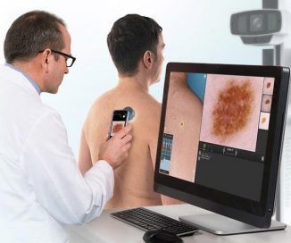 photo of dermagraphix mole mapping