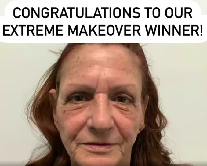 Siperstein Dermatology extreme makeover winner