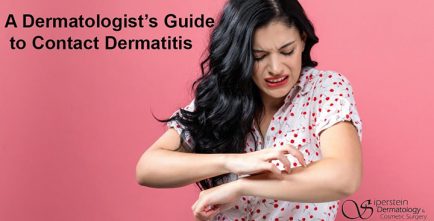 A Dermatologist’s Guide To Contact Dermatitis - Siperstein Dermatology 